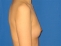 û_